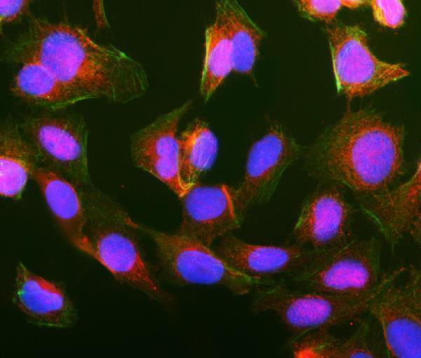 a04969 4 gipc1 primary antibodies if testing 8