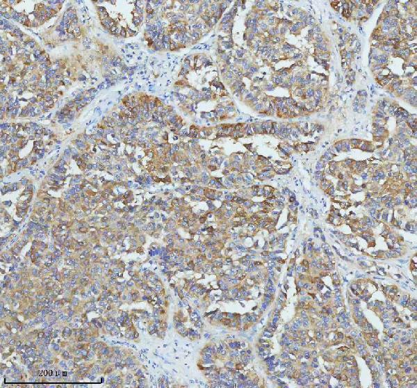  IHC analysis of GIPC1 using anti-GIPC1 antibody (A04969-4)