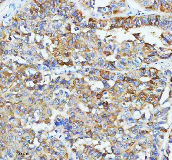  IHC analysis of GIPC1 using anti-GIPC1 antibody (A04969-4)