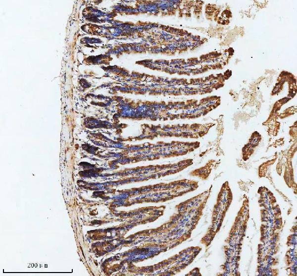 a04969 4 gipc1 primary antibodies ihc testing 4