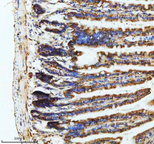 a04969 4 gipc1 primary antibodies ihc testing 5