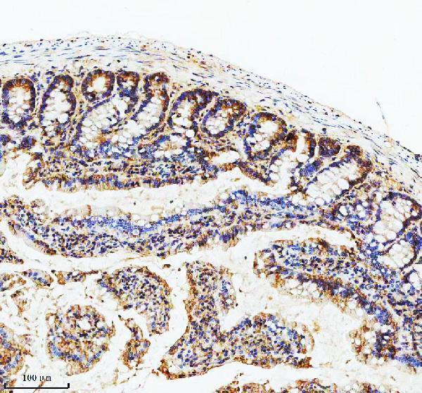 a04969 4 gipc1 primary antibodies ihc testing 6