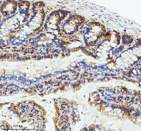 a04969 4 gipc1 primary antibodies ihc testing 7
