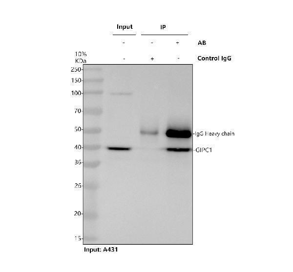 a04969 4 gipc1 primary antibodies ip testing 1