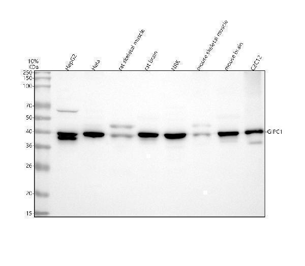  Western blot analysis of GIPC1 using anti-GIPC1 antibody (A04969-4)
