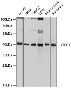 a04969 gipc1 primary antiboties wb testing 1