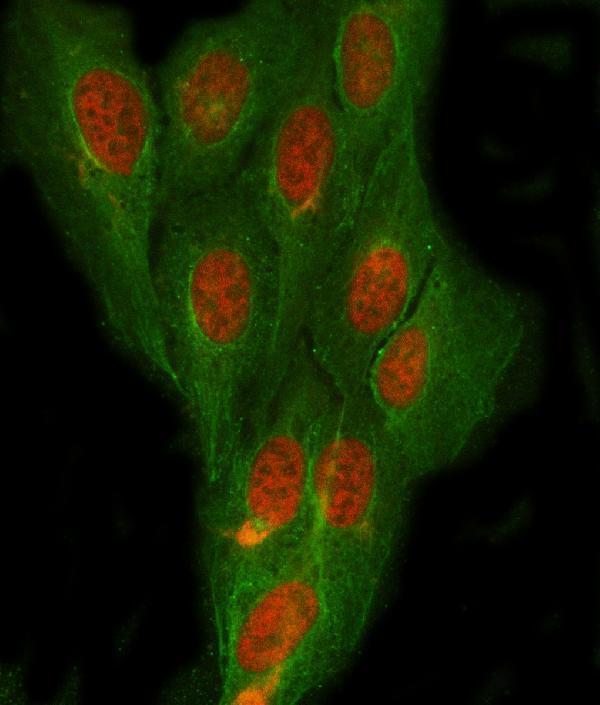  IF analysis of NDRG4 using anti-NDRG4 antibody (A04972-1) and anti-Beta Tubulin antibody (M01857-3)