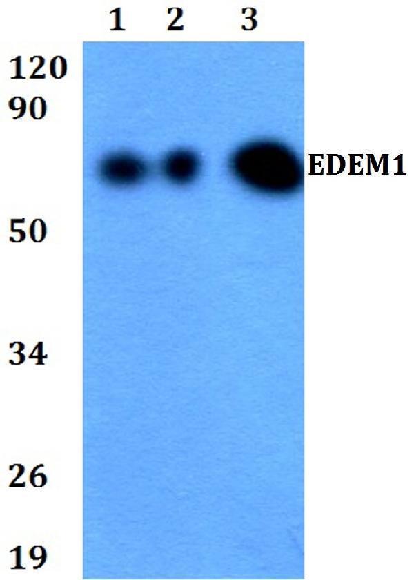 Western blot (WB) analysis of EDEM1 polyclonal antibody at 1:500 dilution
Lane1:HEK293T whole cell lysate
Lane2:Raw264