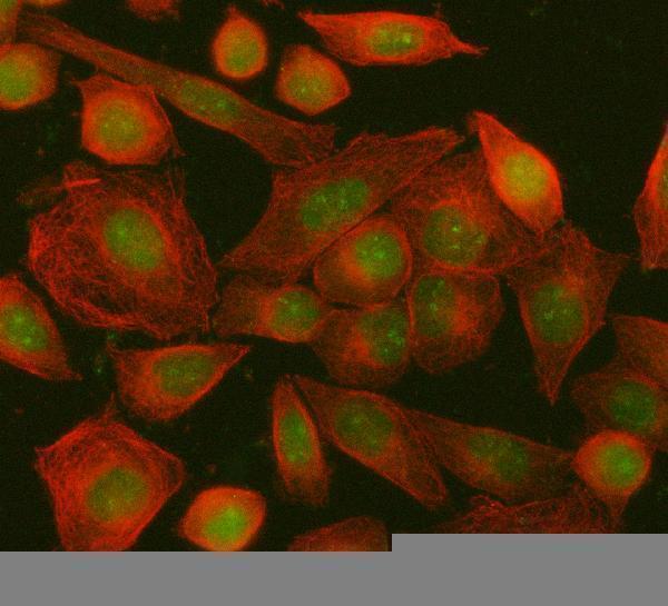  IF analysis of ING5 using anti-ING5 antibody (A04974-3) and anti-Beta Tubulin antibody (M01857-3)
