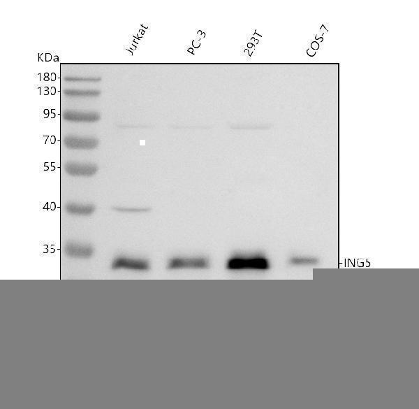  Western blot analysis of ING5 using anti-ING5 antibody (A04974-3)