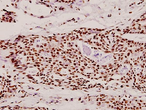 a04975 1 dlx4 primary antiboties ihc testing 2