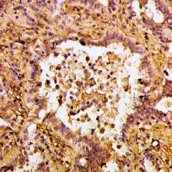 a04976 rgs14 primary antiboties ihc testing 2