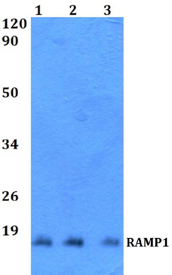 Western blot (WB) analysis of RAMP1 polyclonal antibody at 1:500 dilution
Lane1:Hela whole cell lysate
Lane2:NIH-3T3 whole cell lysate 
Lane3:H9C2 whole cell lysate 