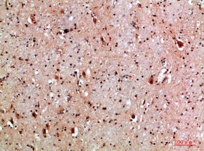 a04980 1 nlrx1 primary antibodies ihc testing 1
