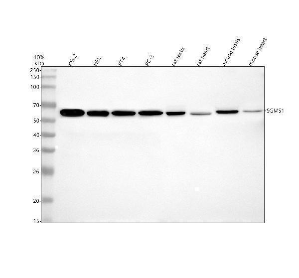  Western blot analysis of SGMS1 using anti-SGMS1 antibody (A04981-1)