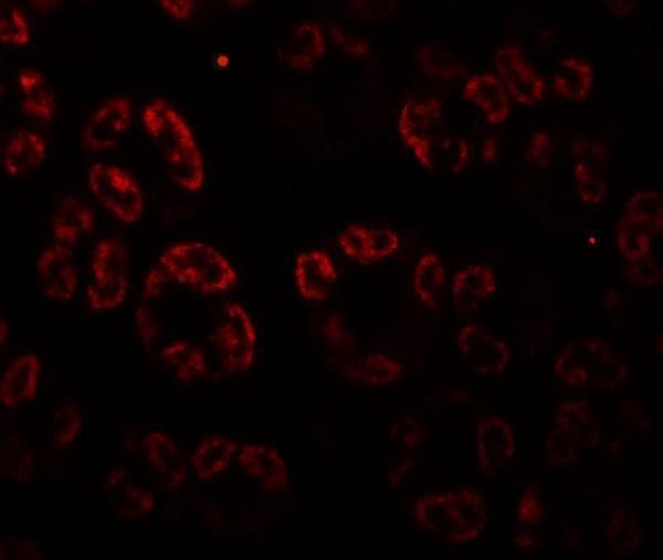 a04982 skiv2l primary antibodies if testing 3