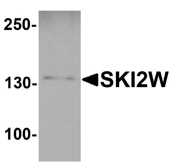 a04982 skiv2l primary antibodies wb testing 1