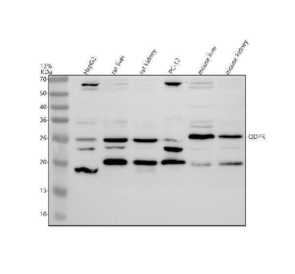 Western blot analysis of QDPR using anti-QDPR antibody (A04983-1)