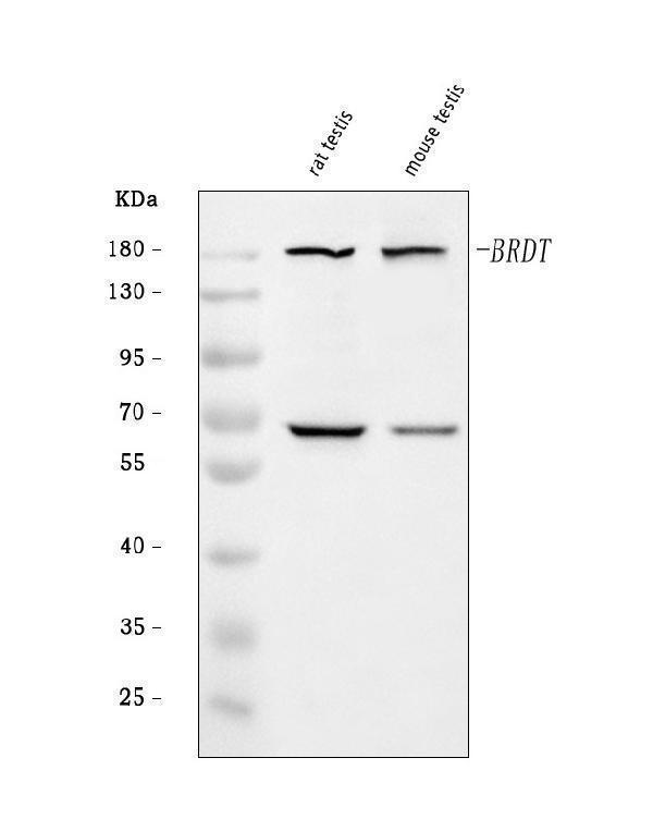  Western blot analysis of BRDT using anti-BRDT antibody (A04985-2)