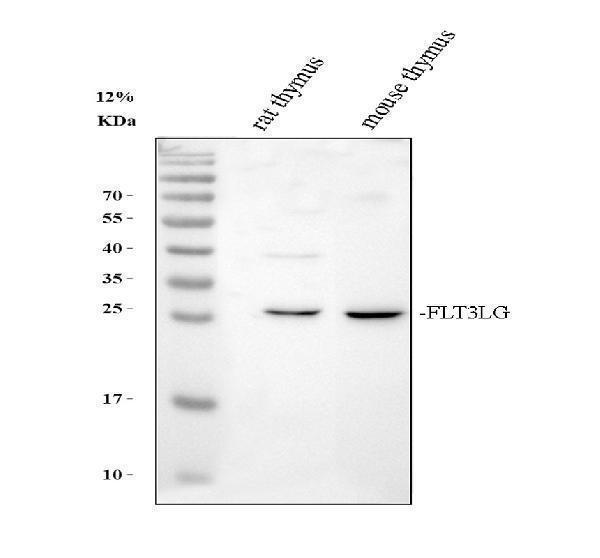 Western blot analysis of Flt3 ligand using anti-Flt3 ligand antibody (A04987-1)