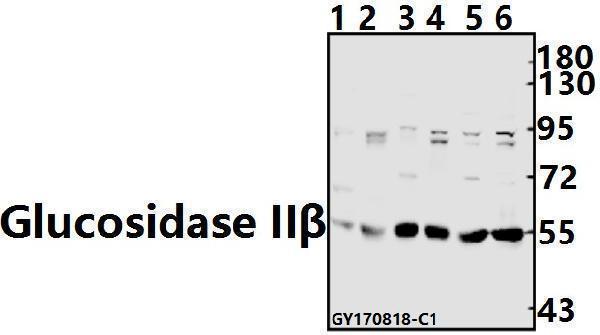 Western blot (WB) analysis of Glucosidase IIβ (K117) pAb at 1:500 dilution
Lane1:The Testis tissue lysate of Mouse(40ug)
Lane2:The Testis tissue lysate of Rat(40ug)
Lane3:SGC7901 whole cell lysate(40ug)
Lane4:HCT116 whole cell lysate(40ug)
Lane5:A549 whole cell lysate(40ug)
Lane6:MCF-7 whole cell lysate(40ug)