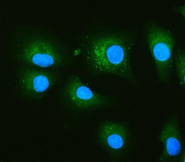  IF analysis of PRKCSH using anti-PRKCSH antibody (A04992-2)