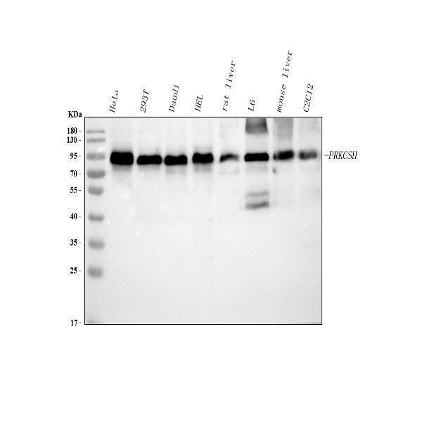  Western blot analysis of PRKCSH using anti-PRKCSH antibody (A04992-2)