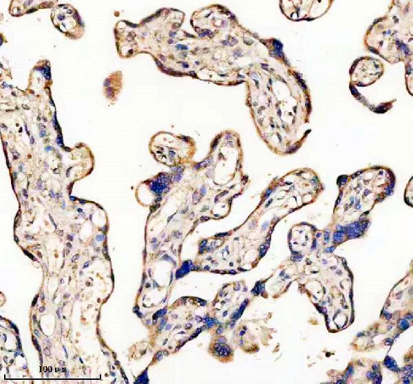 IHC analysis of KLKB1 using anti-KLKB1 antibody (A04995-2)