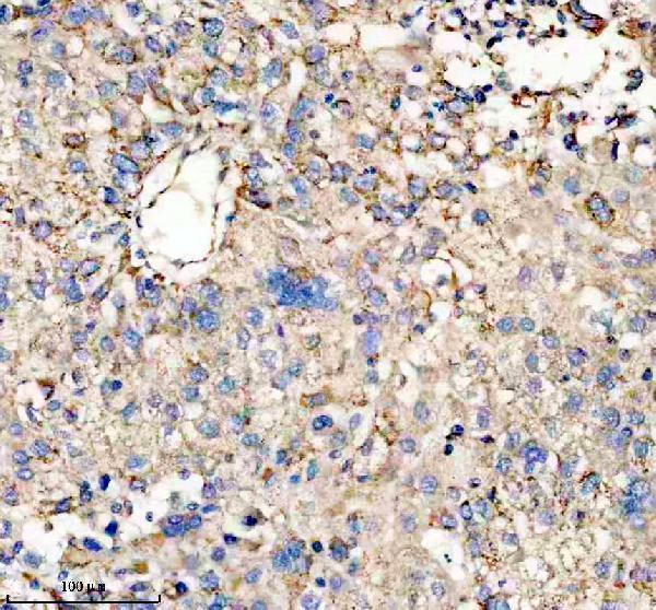 IHC analysis of KLKB1 using anti-KLKB1 antibody (A04995-2)