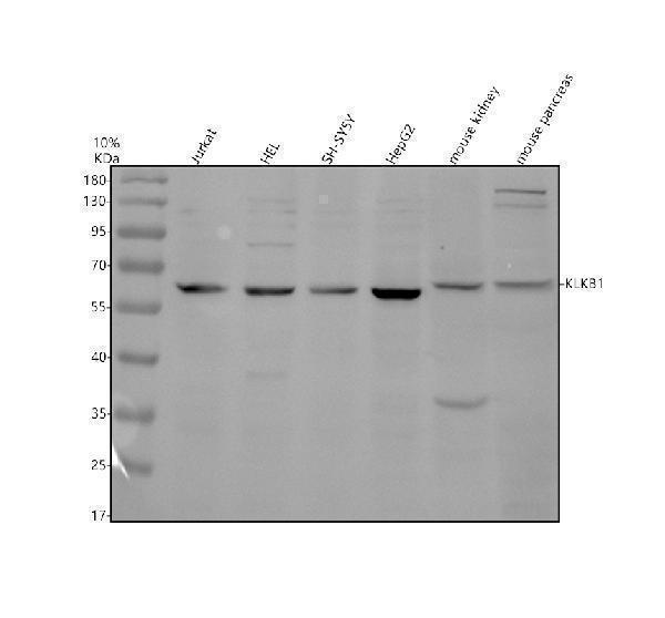 Western blot analysis of KLKB1 using anti-KLKB1 antibody (A04995-2)