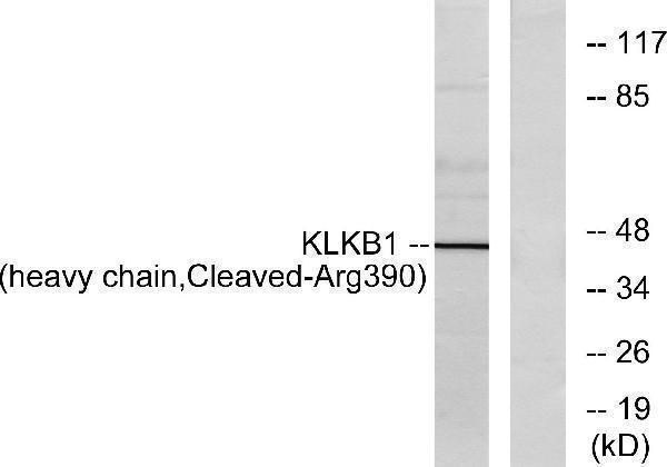 a04995 klkb1 primary antibodies wb testing 1