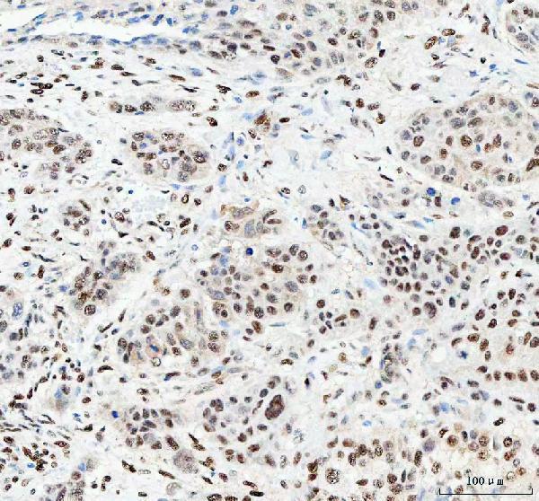  IHC analysis of NUCKS1 using anti-NUCKS1 antibody (A04997-3)
