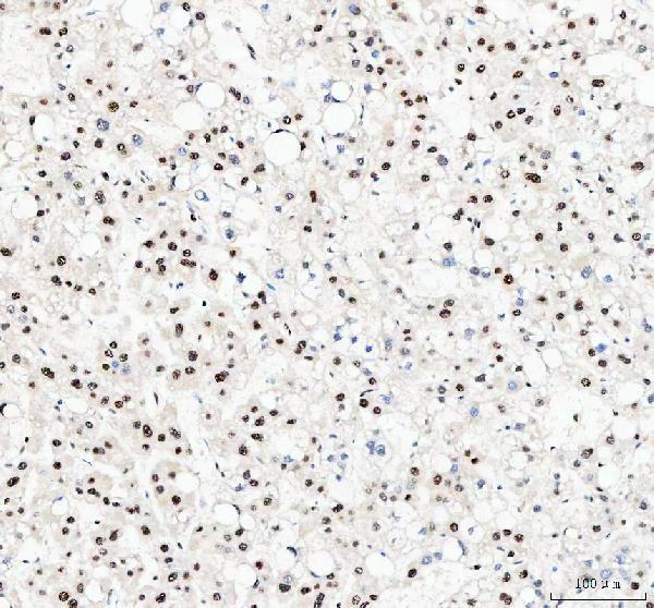  IHC analysis of NUCKS1 using anti-NUCKS1 antibody (A04997-3)