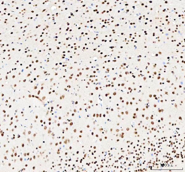 a04997 3 nucks1 primary antibodies ihc testing 7