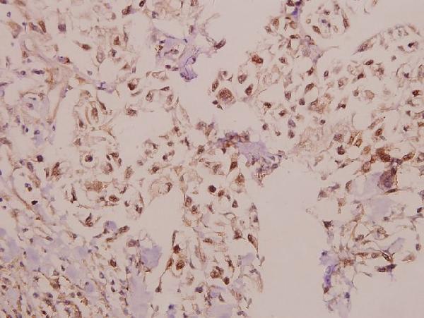 a04999 1 lama4 primary antiboties ihc testing 2