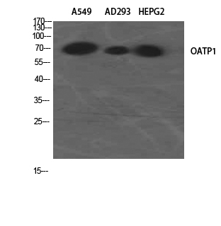 a05001 slco1a2 primary antibodies wb testing 3