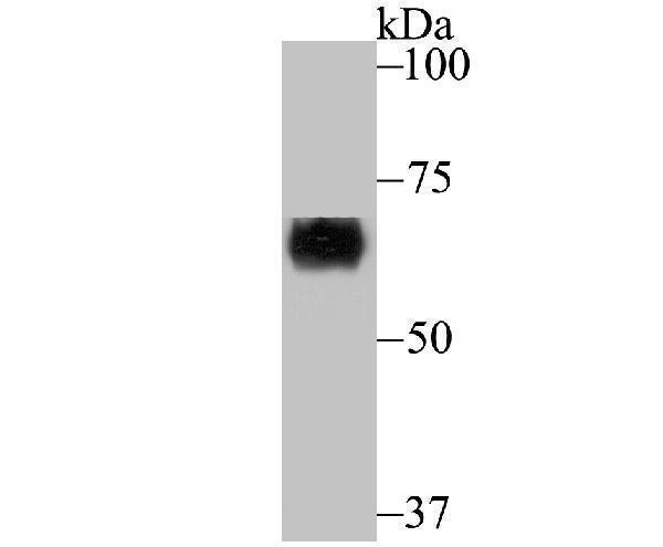 a05002 1 crmp1 primary antiboties wb testing 1