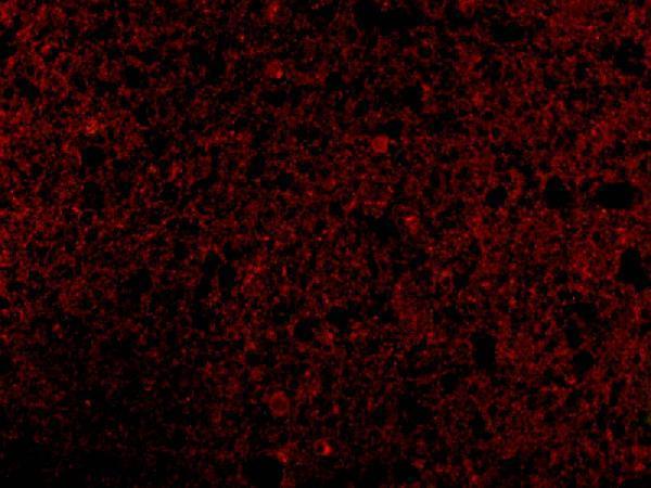 a05002 crmp1 primary antibodies if testing 3