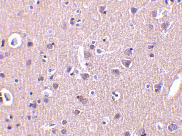 a05002 crmp1 primary antibodies ihc testing 2