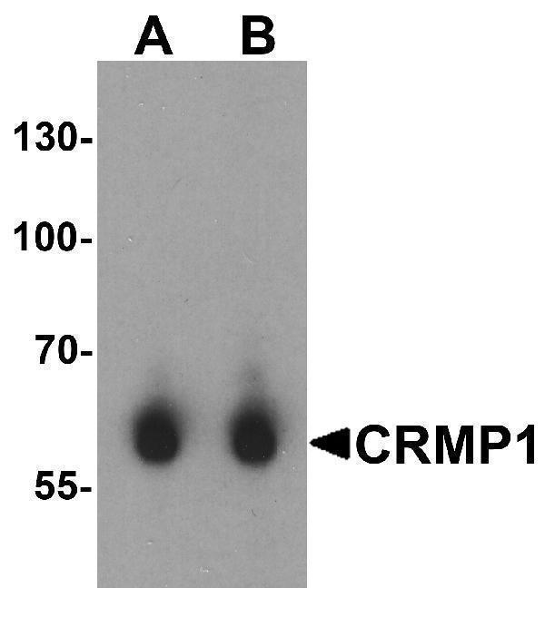 a05002 crmp1 primary antibodies wb testing 1
