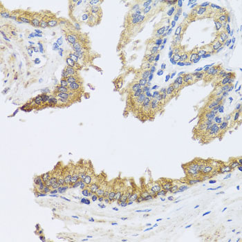 Immunohistochemistry of paraffin-embedded human prostate using ARL6 antibody  at dilution of 1:100 
