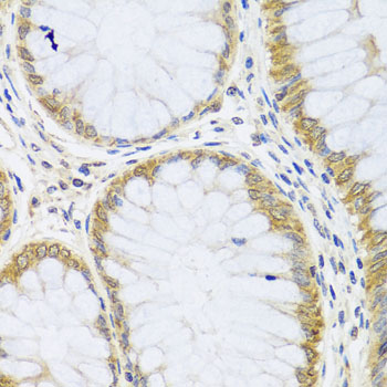 Immunohistochemistry of paraffin-embedded human colon using ARL6 antibody  at dilution of 1:100 