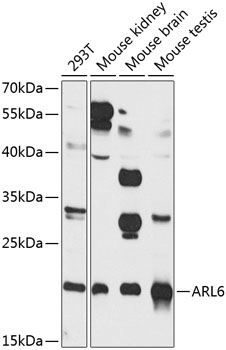 Western blot analysis of extracts of various cell lines, using ARL6 antibody  at 1:1000 dilution