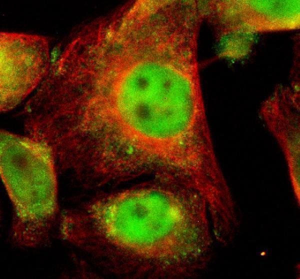 a05004 1 uchl3 primary antibodies if testing 1