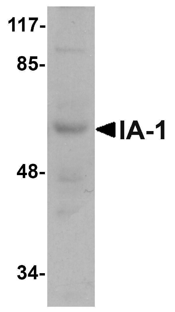 Western blot analysis of IA-1 in rat thymus tissue lysate with IA-1 antibody at 1 μg/mL