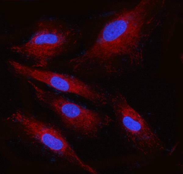  IF analysis of RPN2 using anti-RPN2 antibody (A05006-1)