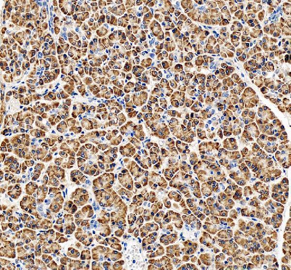 IHC analysis of RPN2 using anti-RPN2 antibody (A05006-1)