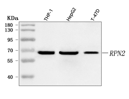  Western blot analysis of RPN2 using anti-RPN2 antibody (A05006-1)