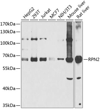 Western blot analysis of extracts of various cell lines, using RPN2 antibody  at 1:1000 dilution