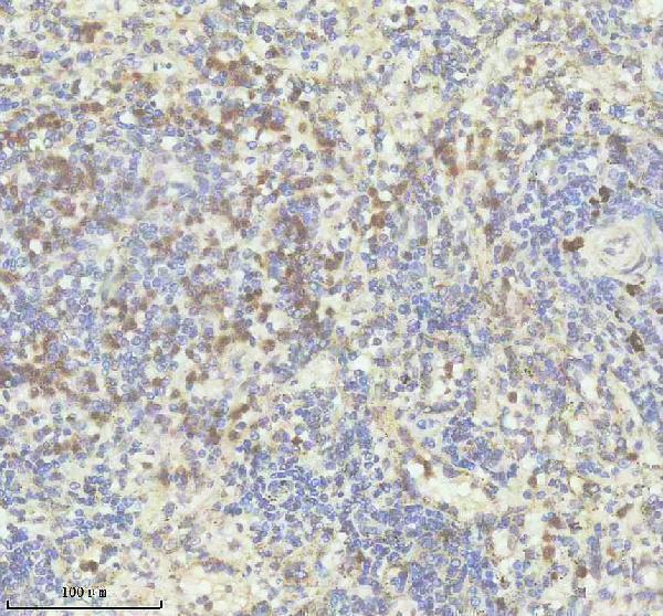 IHC analysis of RASGRP2 using anti-RASGRP2 antibody (A05007-1)